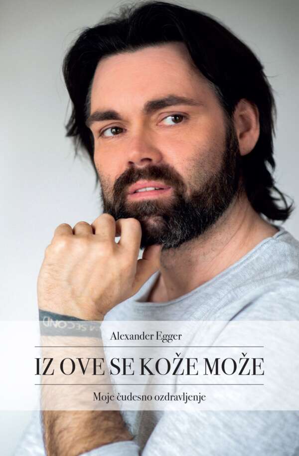 IZ OVE SE KOŽE MOŽE T.U.